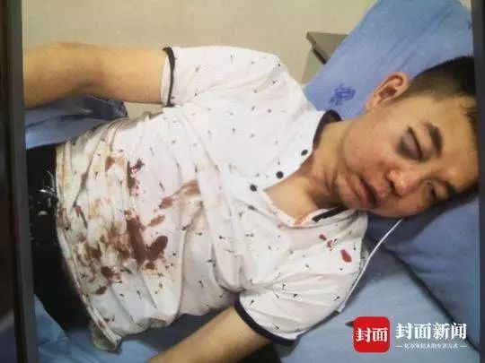 什么程度可以鉴定为轻伤 dd36769ea38c460fa9eda35560345ac8.jpeg