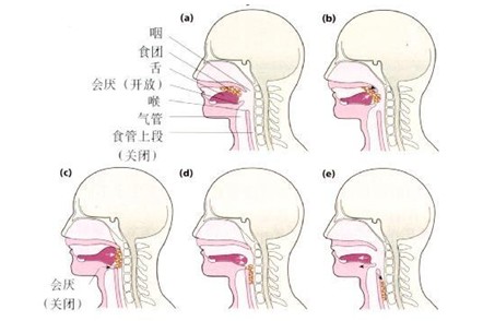 渡康吞咽障碍100讲010吞咽活动可分为三个阶段