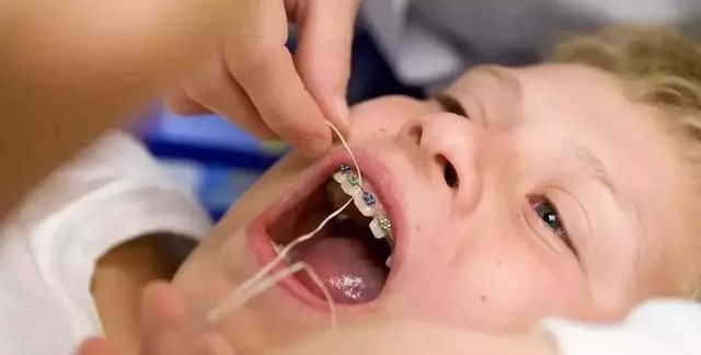 小孩子怎么清理牙齿 e024c908f99848e983d8465164b40f35.jpeg