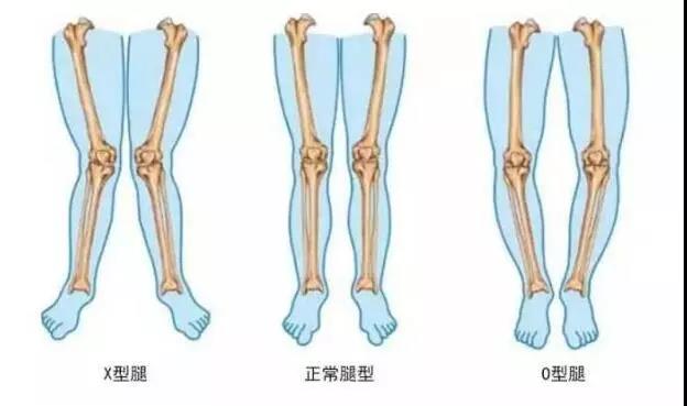 人有多少肌肉多少骨骼 ebfc65897eb247eebc9bb596b03eeeed.jpeg