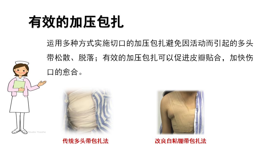 【周四讲堂】乳腺癌术后之皮瓣积液