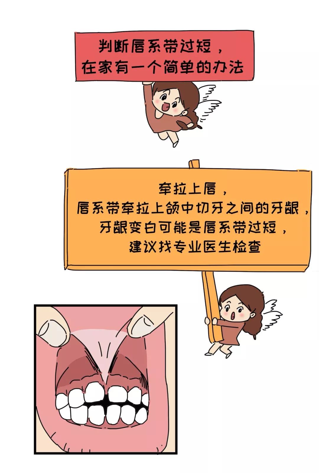                     嘴巴里这两根带子了解下，关乎孩子颜值、出牙、说话……
