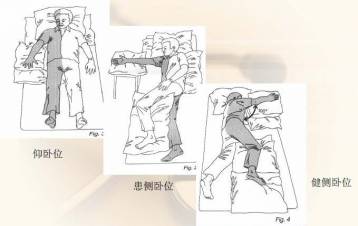 坐位时,在患肢前方放置一平桌,将患肢托起,避免自然下垂.