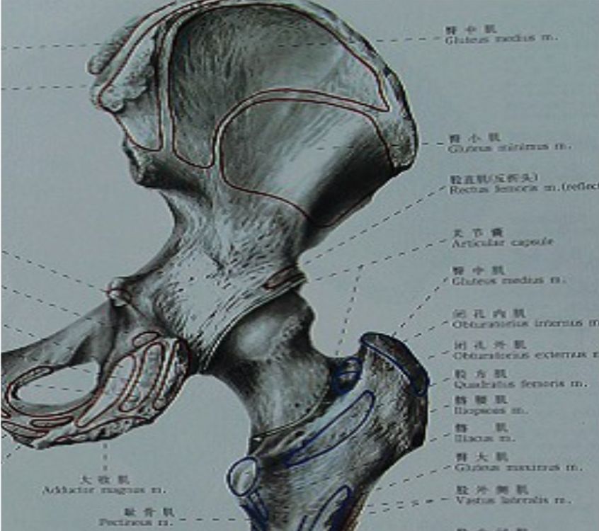 外固定支架技术:老年股骨粗隆间骨折患者的福音