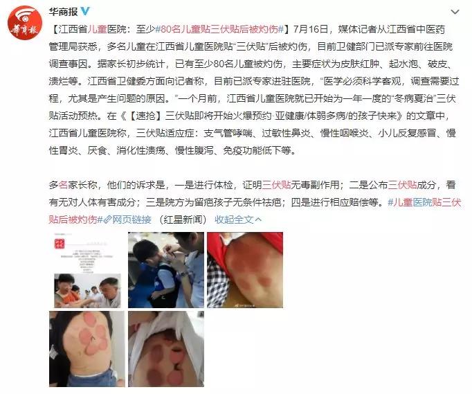                     80名儿童贴三伏贴后被灼伤，到底要不要给宝宝贴三伏贴?