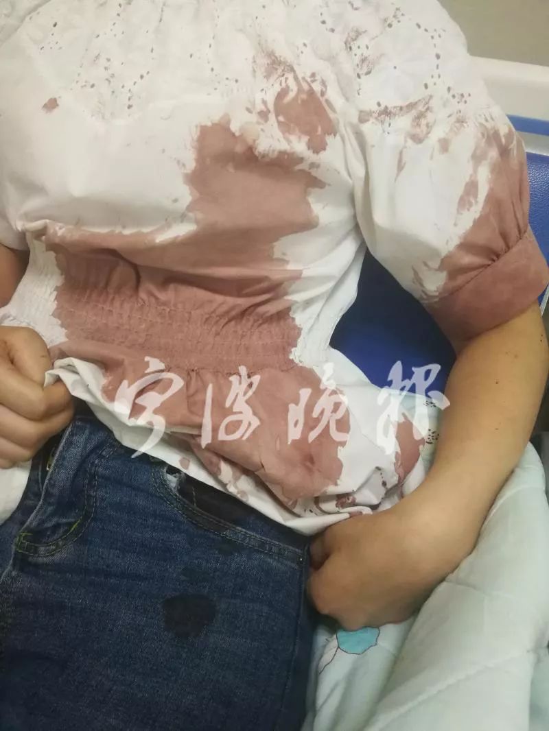 什么手术不能缝伤口 57bbe4e6bdc542048b1ccc0886925810.jpeg