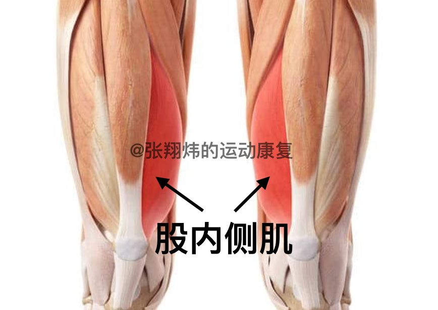 导致膝盖骨(髌骨)往外跑,摩擦到大腿骨