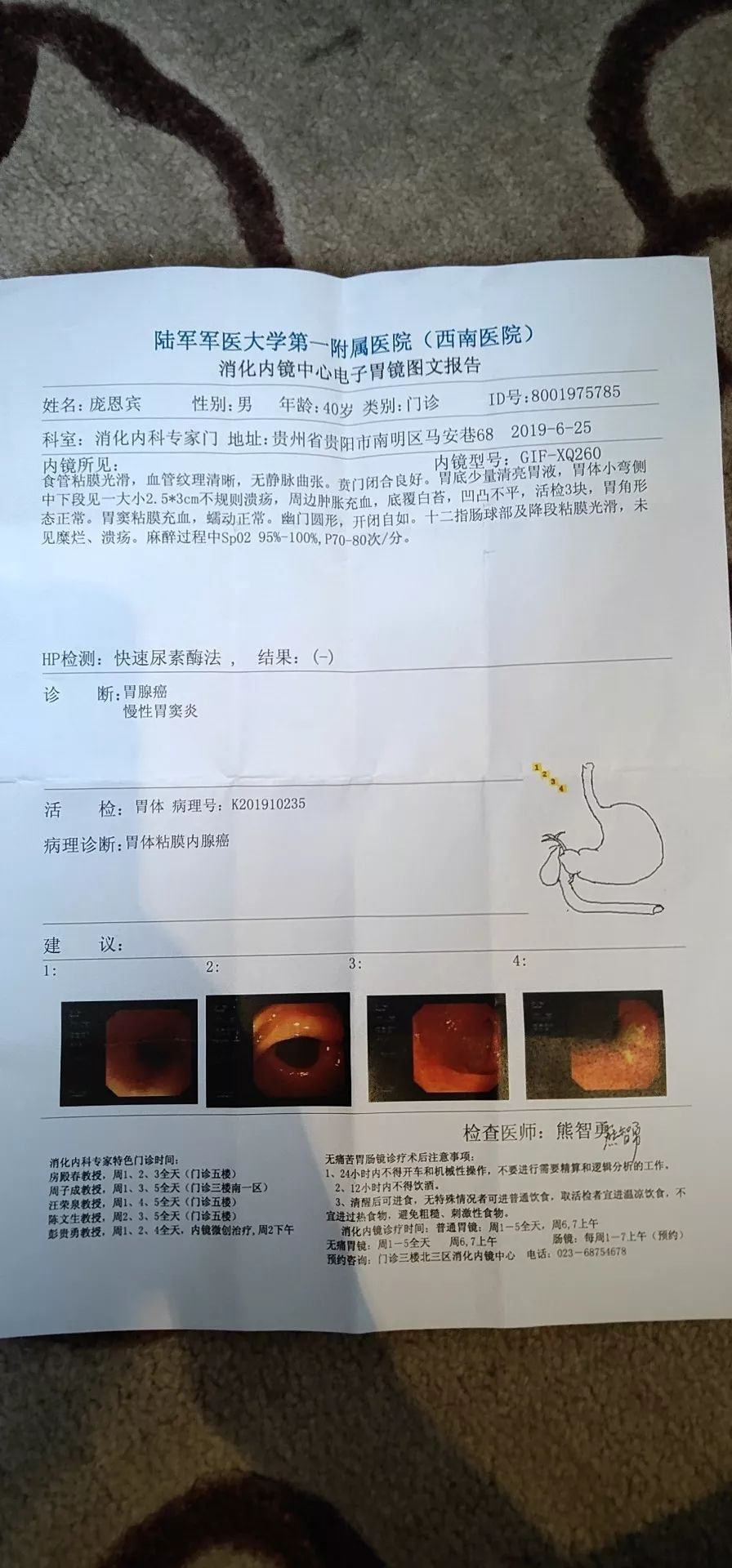 检查后,医生把我叫到一旁,小声说:" 确诊为胃癌中晚期,很可能已经转移