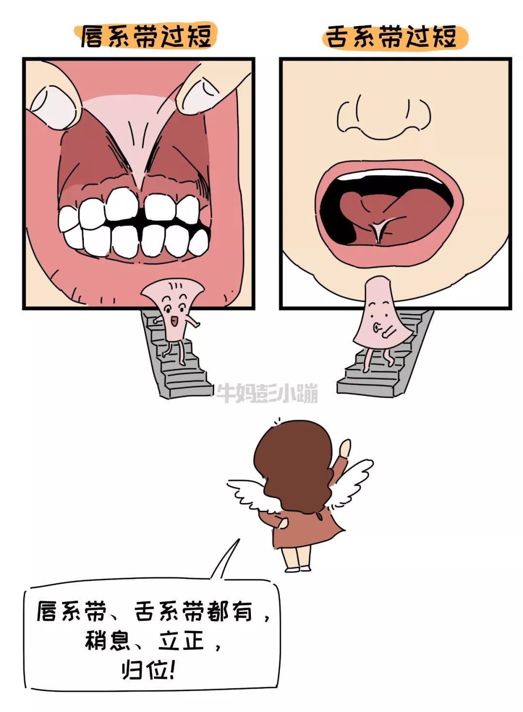                     嘴巴里这两根带子了解下，关乎孩子颜值、出牙、说话……