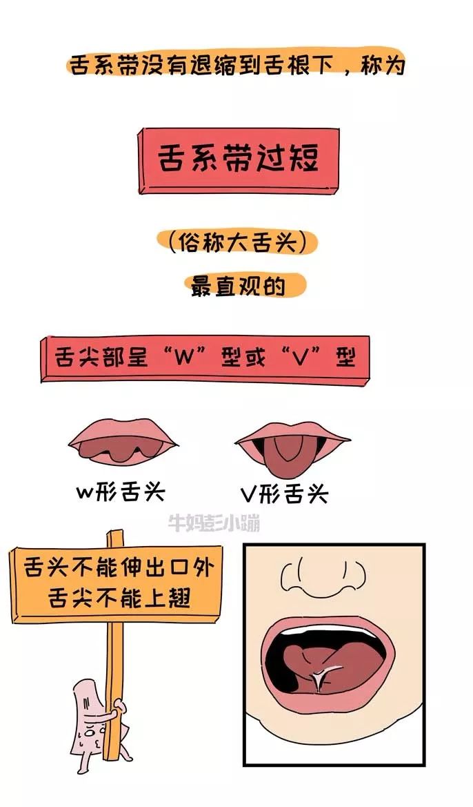                     嘴巴里这两根带子了解下，关乎孩子颜值、出牙、说话……