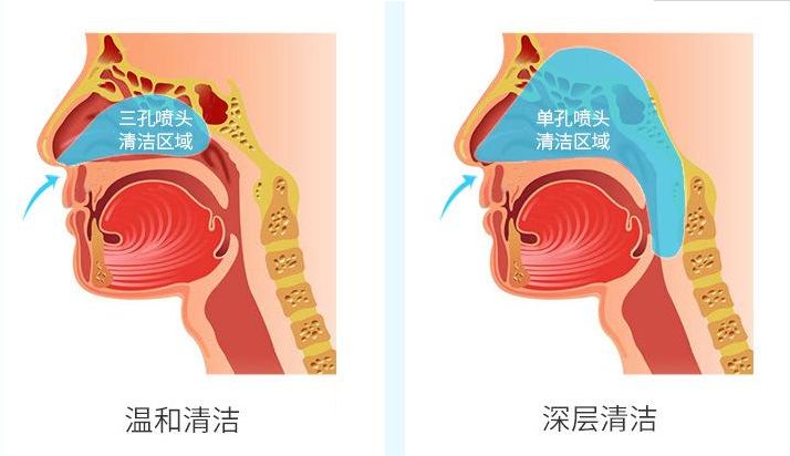 鼻腔居然比马桶还要脏?一直被忽视的鼻腔冲洗,其实很必要 !