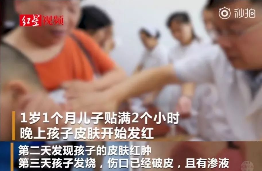                     烫人的网红三伏贴