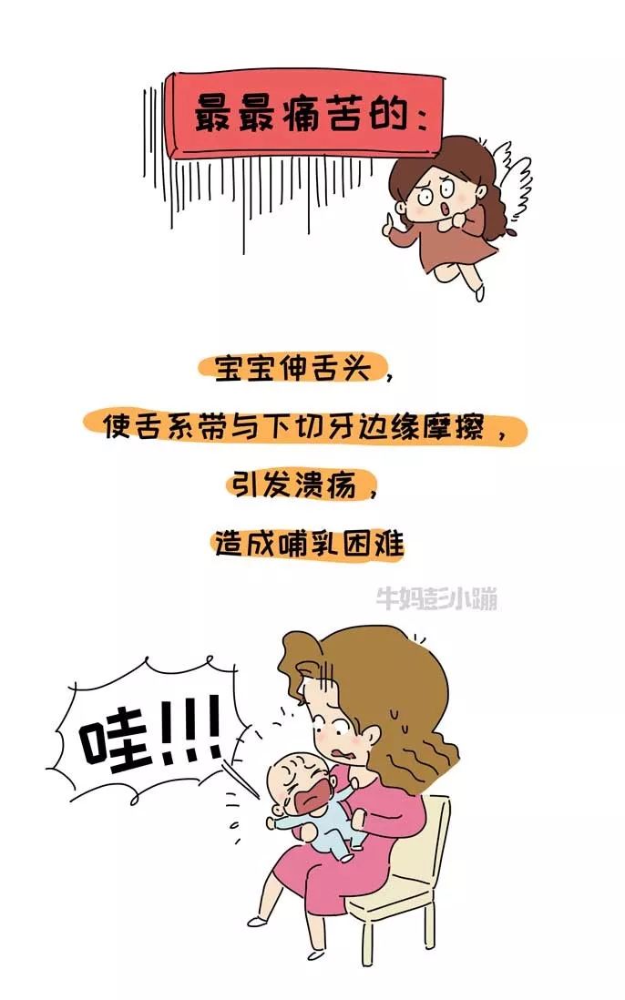                     嘴巴里这两根带子了解下，关乎孩子颜值、出牙、说话……