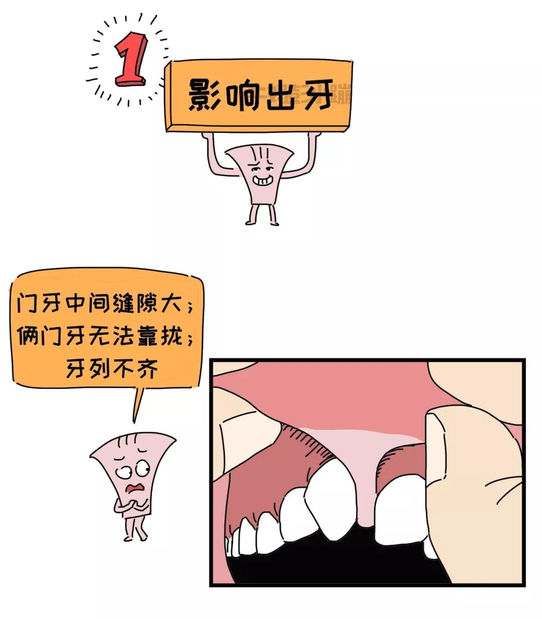                     嘴巴里这两根带子了解下，关乎孩子颜值、出牙、说话……