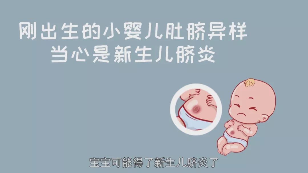刚出生的小婴儿肚脐异样,当心是新生儿脐炎