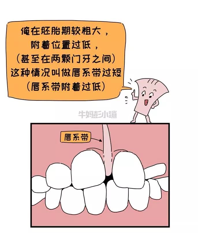                     嘴巴里这两根带子了解下，关乎孩子颜值、出牙、说话……