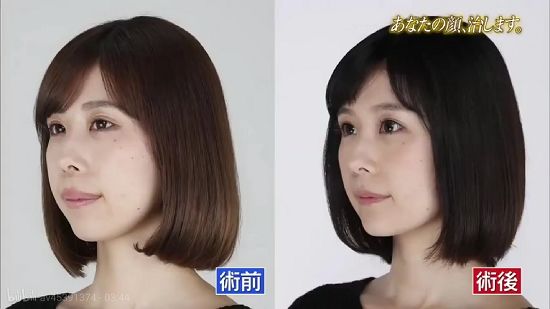 中国女生赴日整容成流行 日本整形院长称80 顾客都是中国人 美容