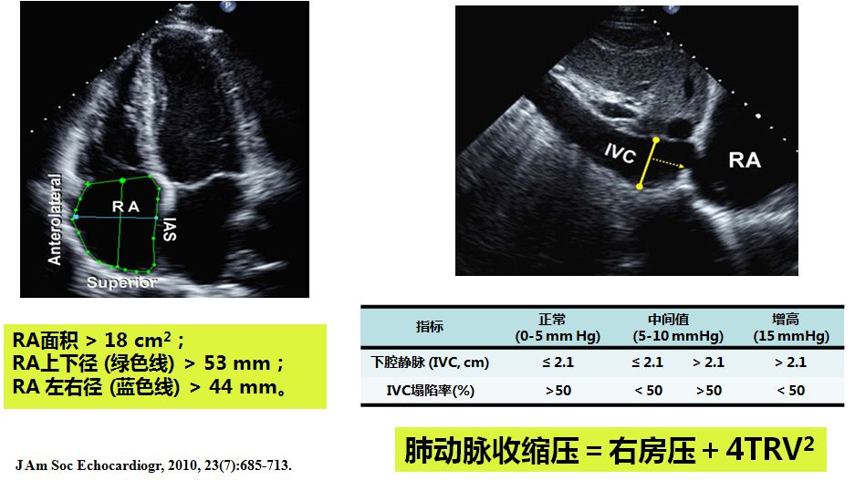 2019cihfc周蕾教授超声心动图在心力衰竭评估中的应用