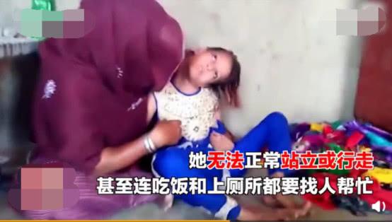                     11岁女孩脖子向左扭曲90度，竟因小时候跌倒，家人没重视