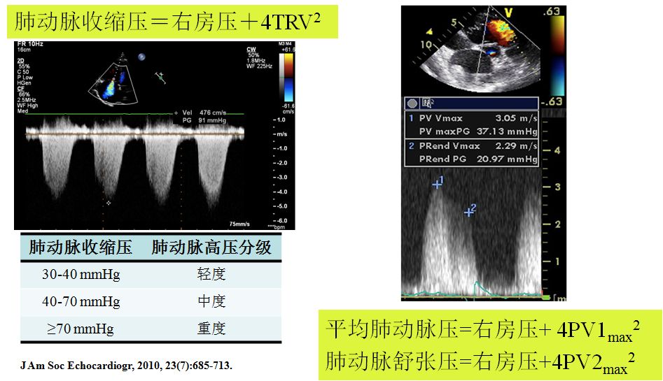 【2019cihfc】周蕾教授:超声心动图在心力衰竭评估中的应用_左室