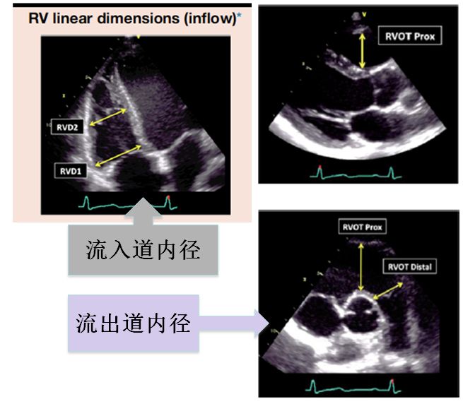 2019cihfc周蕾教授超声心动图在心力衰竭评估中的应用