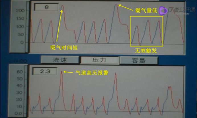 (模拟胸外按压时呼吸机波形)