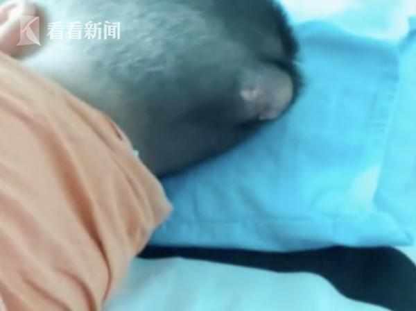 3岁男童头上长出“犄角”家属:医生曾建议放弃但舍不得 xbet官网手机版