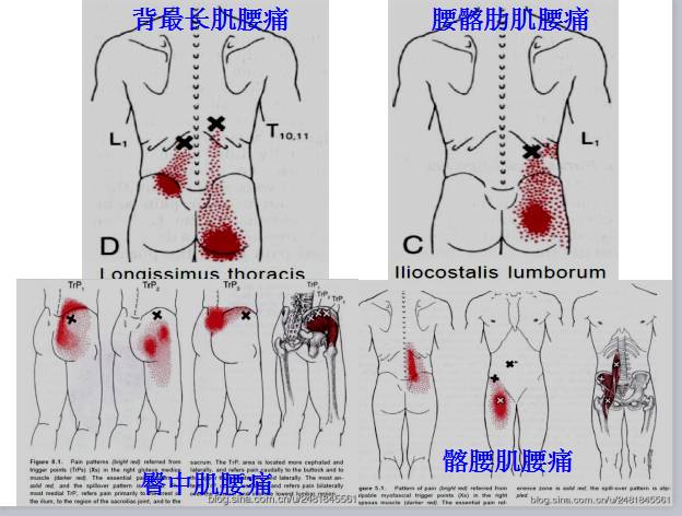全身激痛点手册,附带3d动画视频,非常有用【疼痛医生必看】