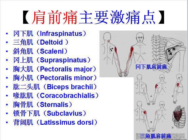 全身激痛点手册附带3d动画视频非常有用疼痛医生必看