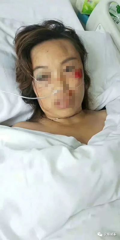 爱心接力下,今天上午出车祸的伤者已找到家属