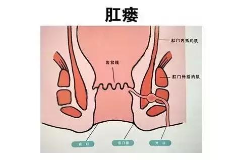 带你全面解读肛痿的危害