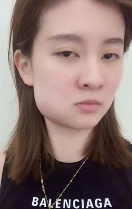 乔欣拔完智齿后素颜出镜脸肿得像个小仓鼠但莫名的好有喜感