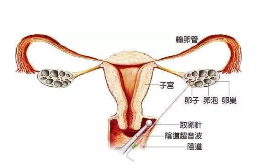 原创继裸贷之后又一手段成女人陷阱,起心动念却后患无穷,哭诉无门