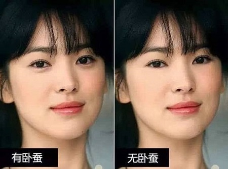 陈浩民被p掉卧蚕:眼袋和卧蚕有什么区别呢?