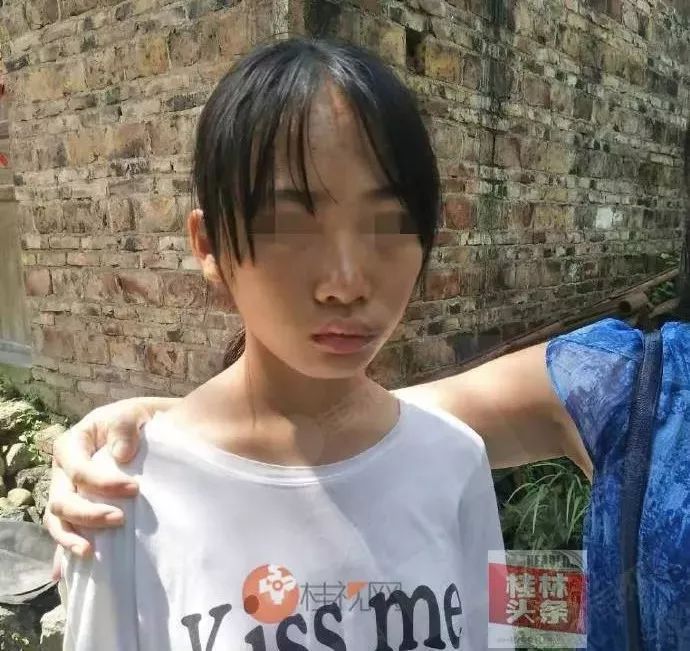 桂林14岁女孩遭父亲家暴,看完让人愤怒!