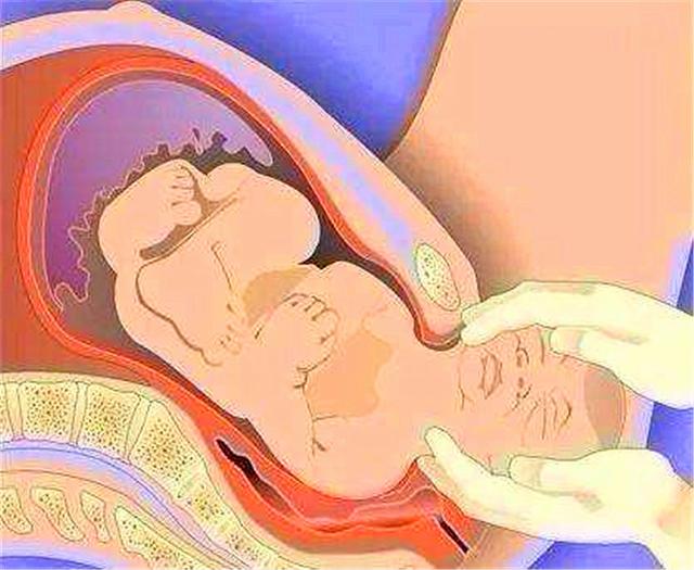 女人在分娩時，為什麼會一邊生一邊「拉粑粑」？醫生：別不好意思 未分類 第5張