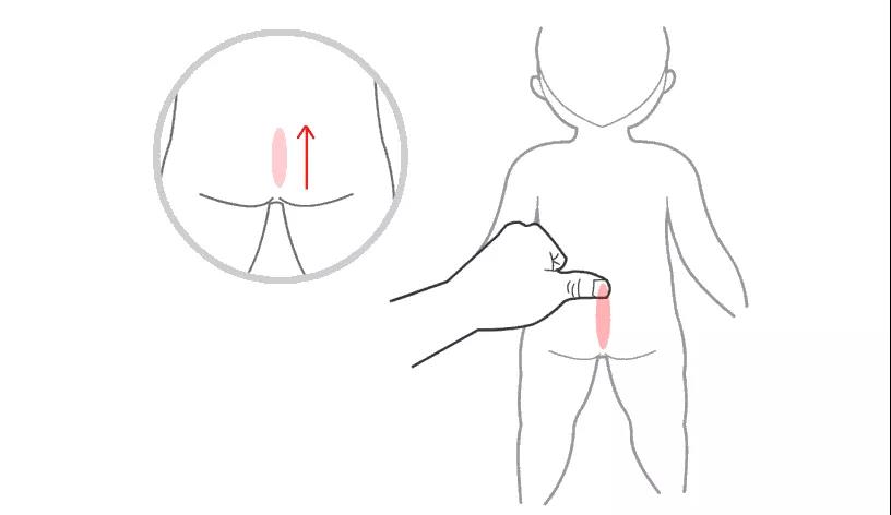 止腹泻10大妙招|夏季宝宝腹泻,推拿可治