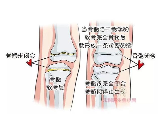                     原创            除了遗传因素，长高的秘密都在这里了，6大诀窍助力孩子长高高