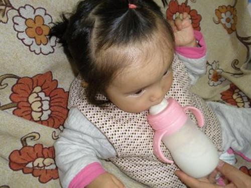                     5岁女娃不吃不喝，积食入院，儿科医生：再疼娃，夏季别做3件事