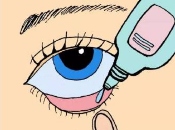 眼药水不要直接滴在黑眼珠上,而是滴入结膜囊内,也就是滴在眼球和下