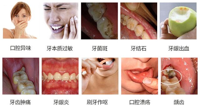 日本乳酸菌漱口水 给口腔加点益生菌 80岁还有20颗健康牙齿 细菌