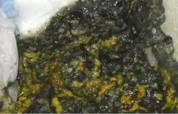                     大便出现这些东西就是消化不良？肯定有你家宝宝那一款