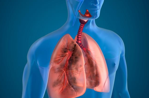3个部位发生异常,是肺在"求救",肺癌已开始潜伏