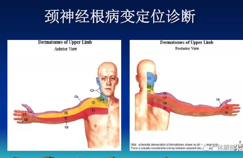 图解颈椎精细解剖颈椎病