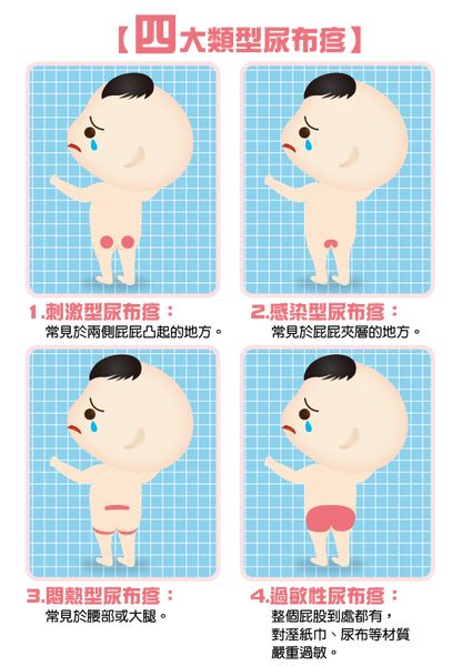                     宝宝红屁屁反复哭闹，真的全赖纸尿裤？