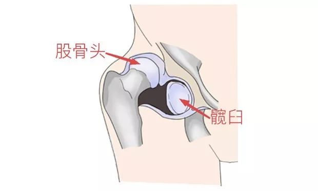                     宝宝腿纹不对称？1岁后发现就晚了！