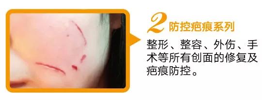 什么是疤痕？疤痕又是如何分类的呢？