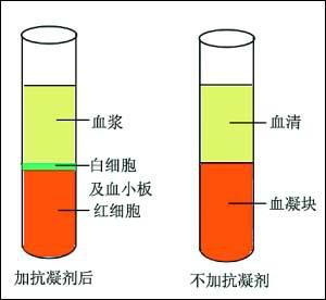 血液凝固的原理_图为血液凝固机理