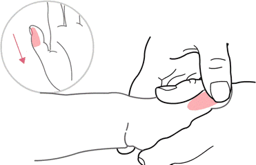                     原创            孩子扁桃体总发炎，需要切除吗？还有其他方法吗？