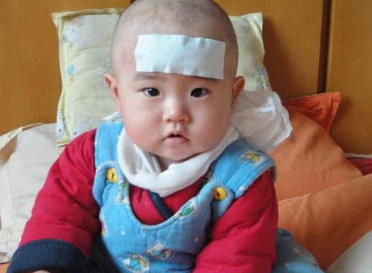                     8岁孩子诊断出肠癌！医生直言：有3种早饭，大人小孩都不能吃